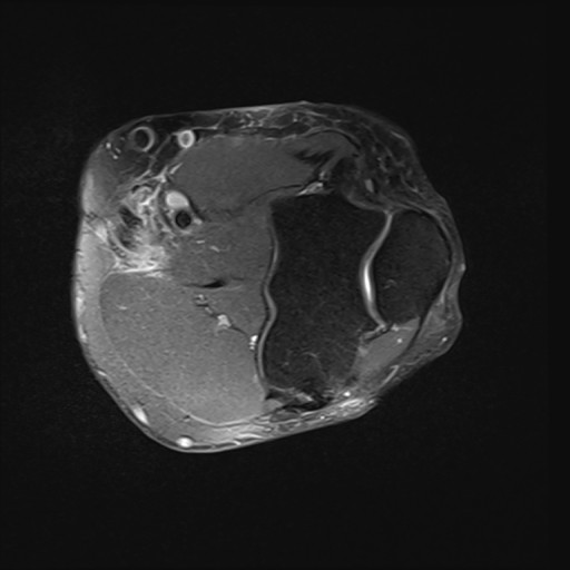 Click on the Serie image to view the images of Wieszt, Gnter